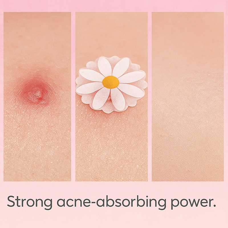 100 قطعة، لصقات علاجية للوجه،  - مراجعة Skincare China وسعره